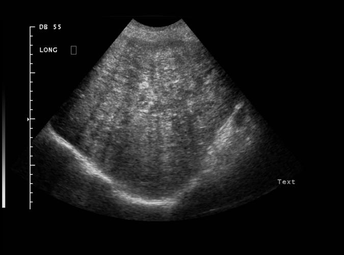 2e av  Catherine Olsson, sonograf